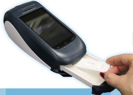 QuickChekTM SRB检测系统