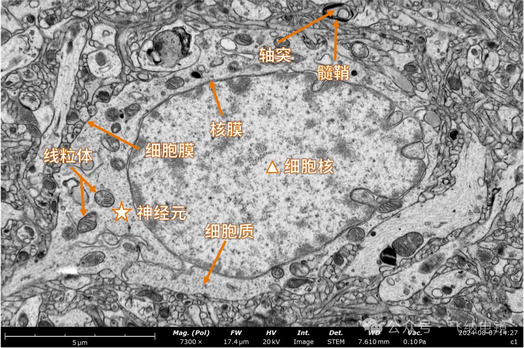 扫描电镜下神经元
