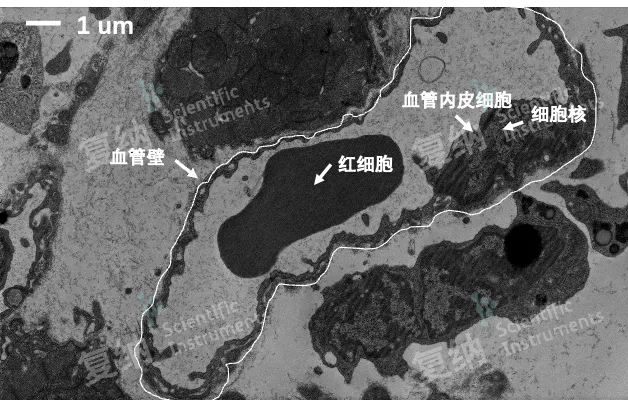 台式扫透电镜:血管、血管内皮细胞、红细胞超微结构