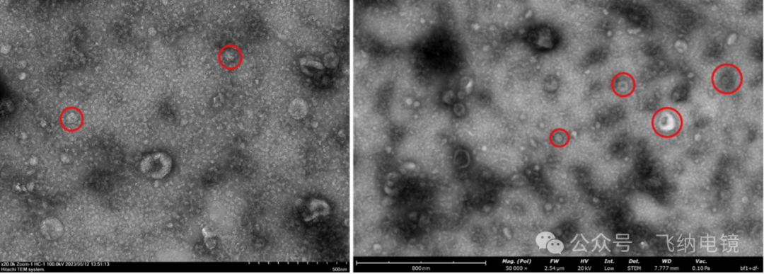 左:外泌体(TEM);右:外泌体(Pharos STEM)