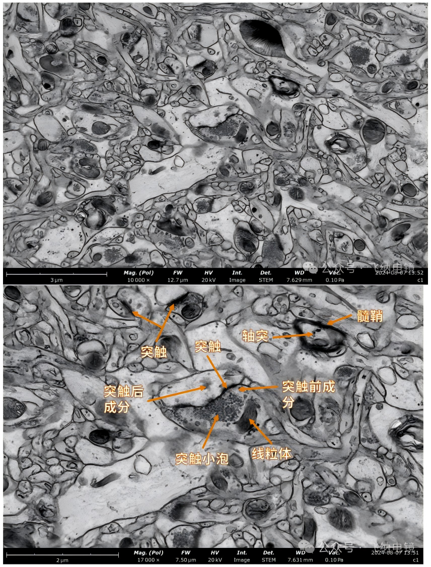 扫描电镜下化学性突触