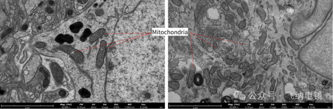 左:染色;右:未染色
