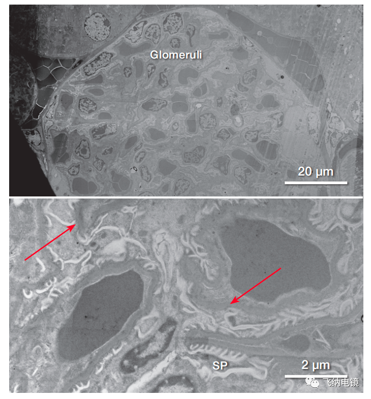 小鼠肾标本样品(肾小球和临近的肾血管)的 STEM 图